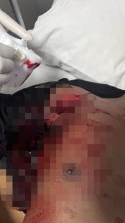 Empat Anggota Brimob Terluka Akibat Penikaman di Labuan Bajo, Oknum TNI Diduga Terlibat