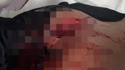 Empat Anggota Brimob Terluka Akibat Penikaman di Labuan Bajo, Oknum TNI Diduga Terlibat
