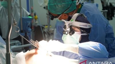 Revaskularisasi Jantung dengan Teknik Bedah Minimal Invasif Revaskularisasi Jantung dengan Teknik Bedah Minimal Invasif